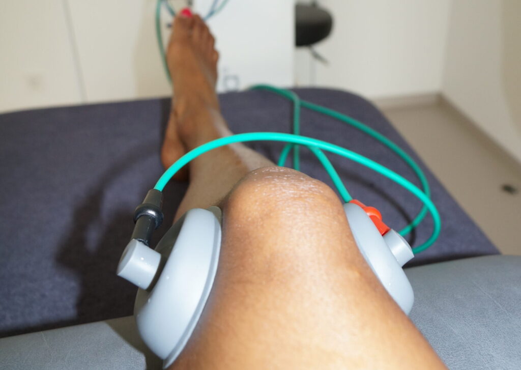 Bein einer Patientin wird mit Elektroden stimuliert